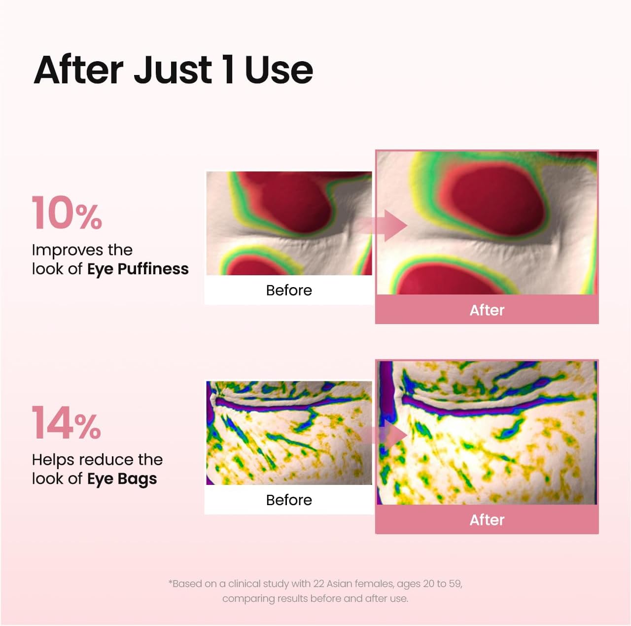 Dew-Lock™ Eye Patches