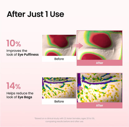 Dew-Lock™ Eye Patches